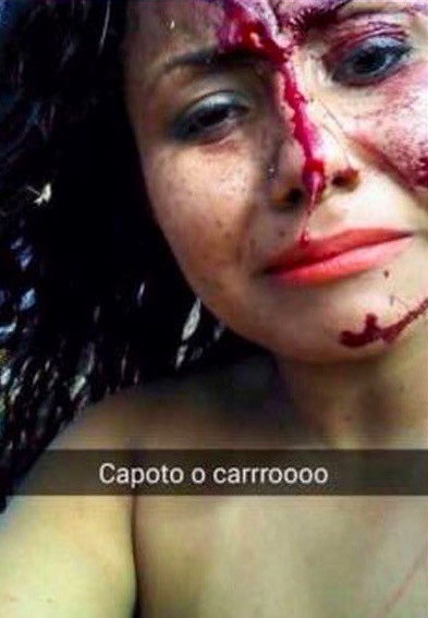Girl’s happy Snapchat Story Turned Painful In No Time (6)